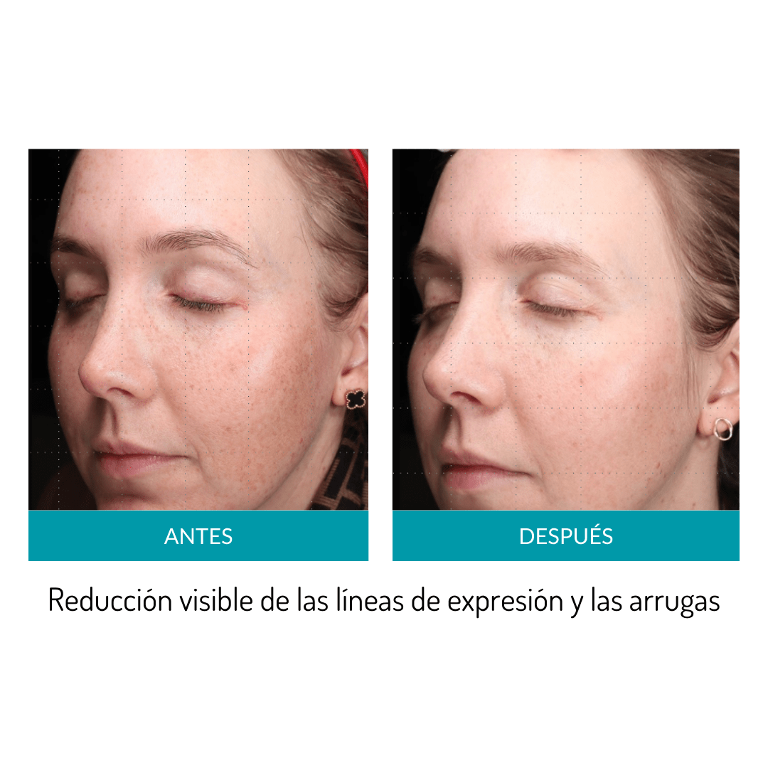 Glo Mask - Máscara antiedad de fototerapia LED de grado médico