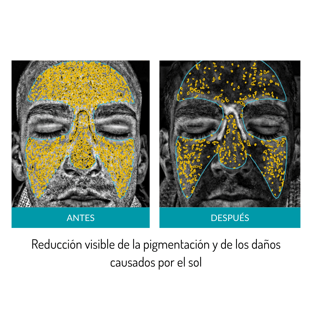 Glo Mask - Máscara antiedad de fototerapia LED de grado médico