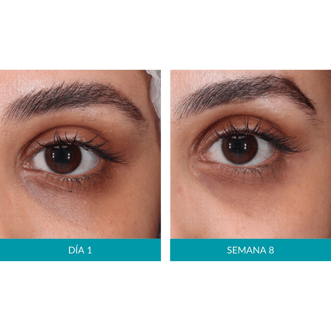 Glo Mask - Máscara antiedad de fototerapia LED de grado médico