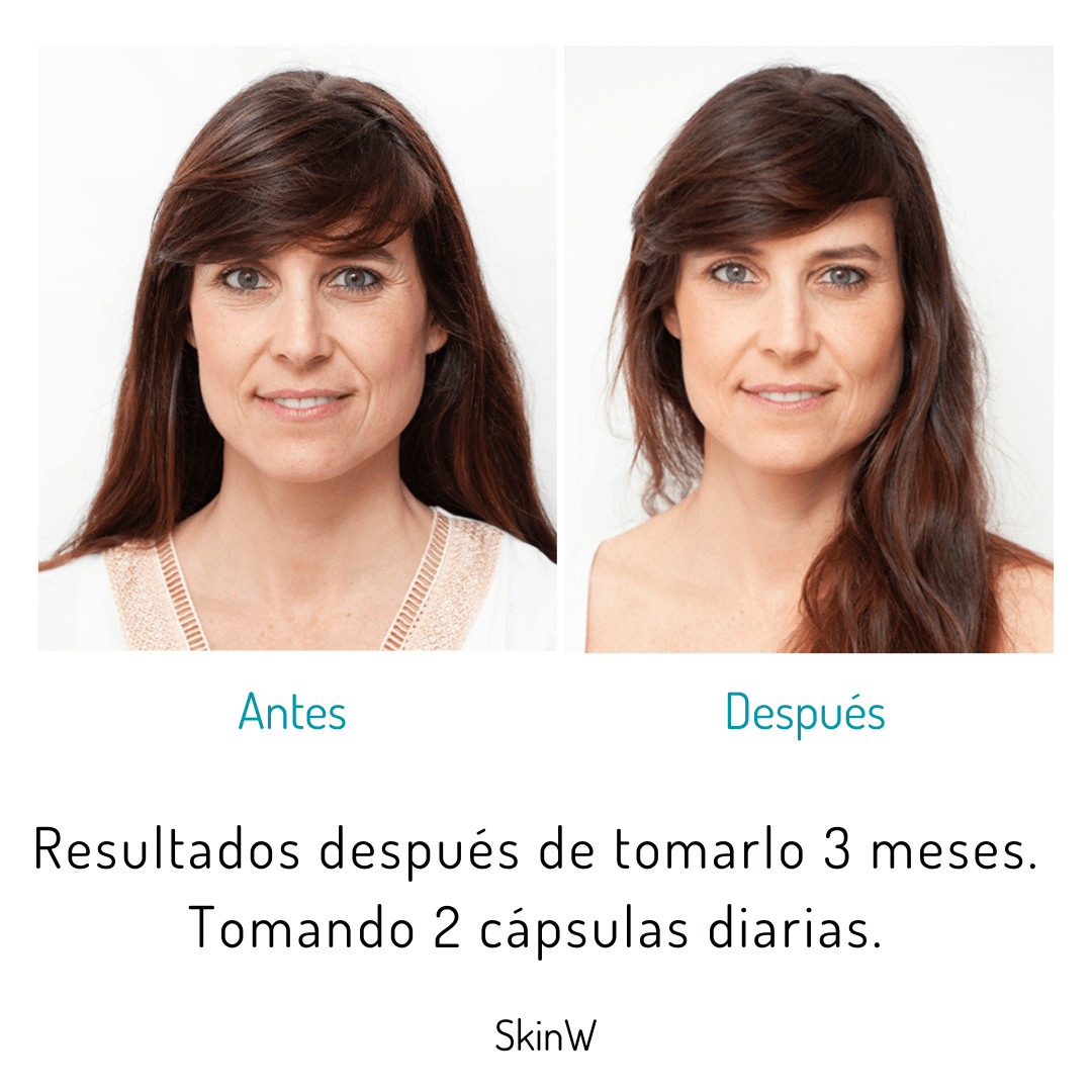 SKINW+