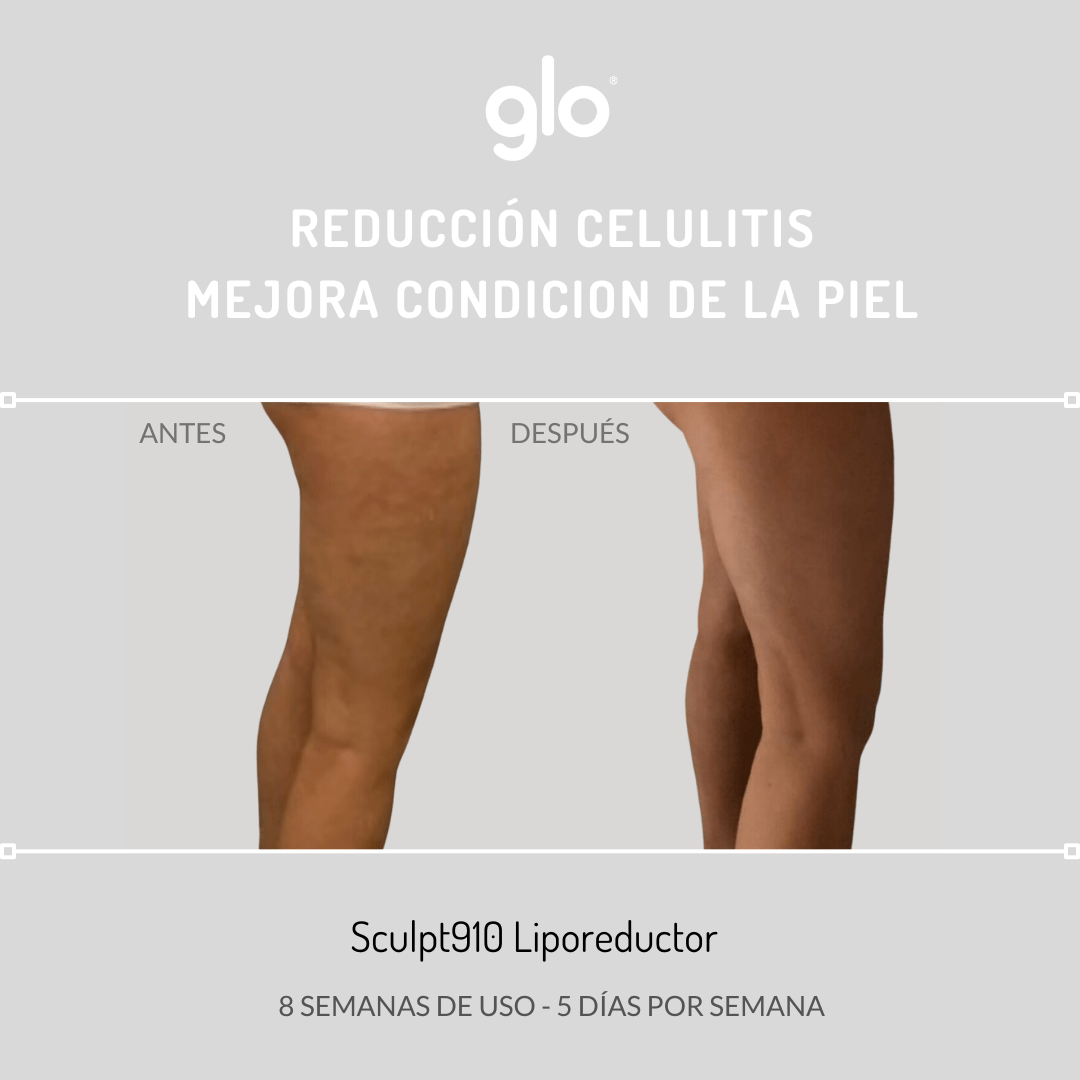 Sculpt910 anticelulitico reductor intensivo