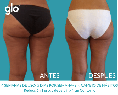 Glo910 Masajeador Anticelulitico El Mas Efectivo