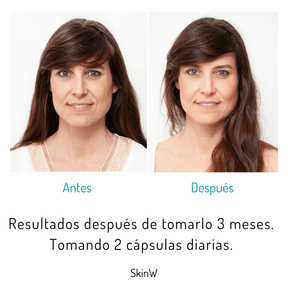 SKINW+